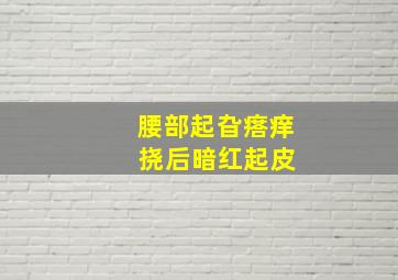 腰部起旮瘩痒 挠后暗红起皮